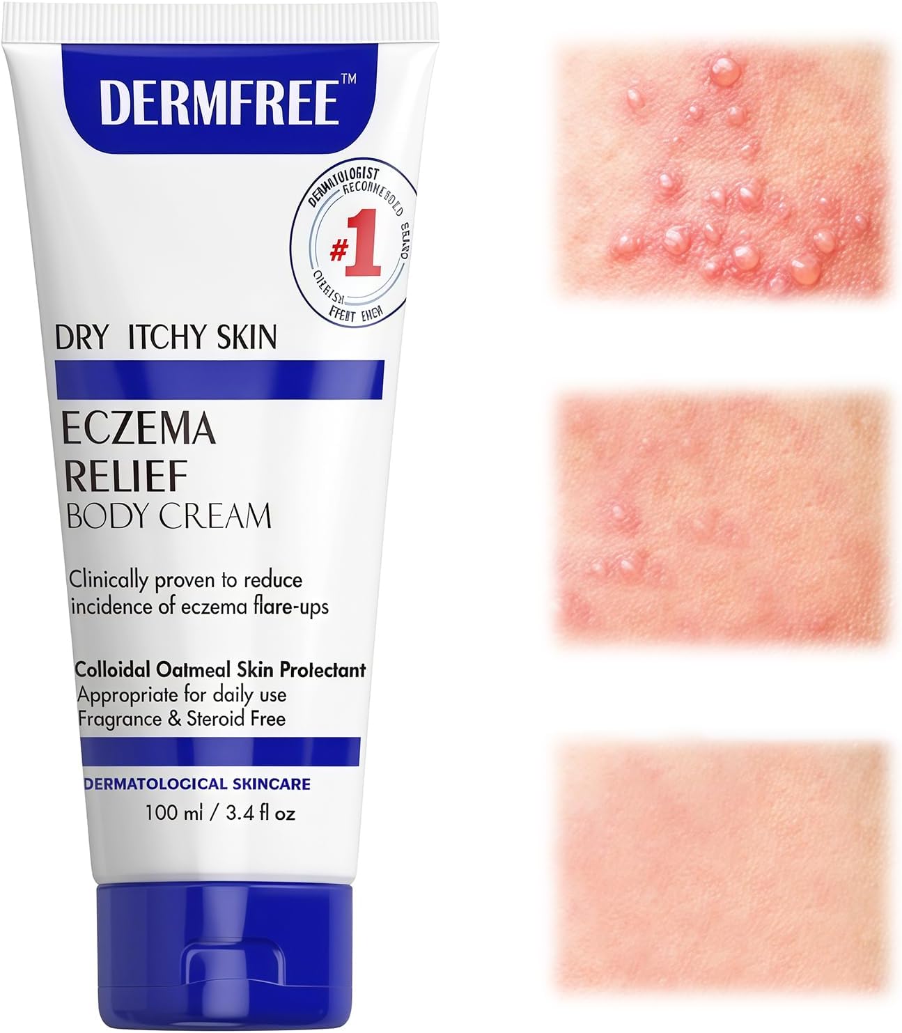 100g Crème pour l'eczéma, pommade apaisante et hydratante pour les peaux, sujettes à l'eczéma, crème emolliente apaisante, Creme Apaisante Creme Hydratante